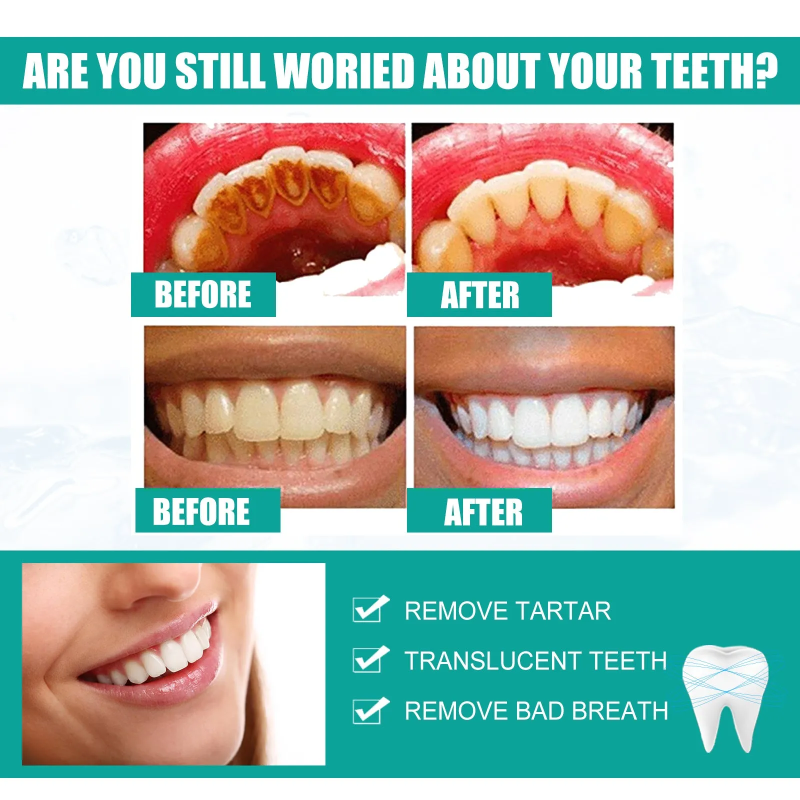 Teeth Pearl Whitening Oral Care Oral Hygiene Removal Tooth Stains Bad Breath